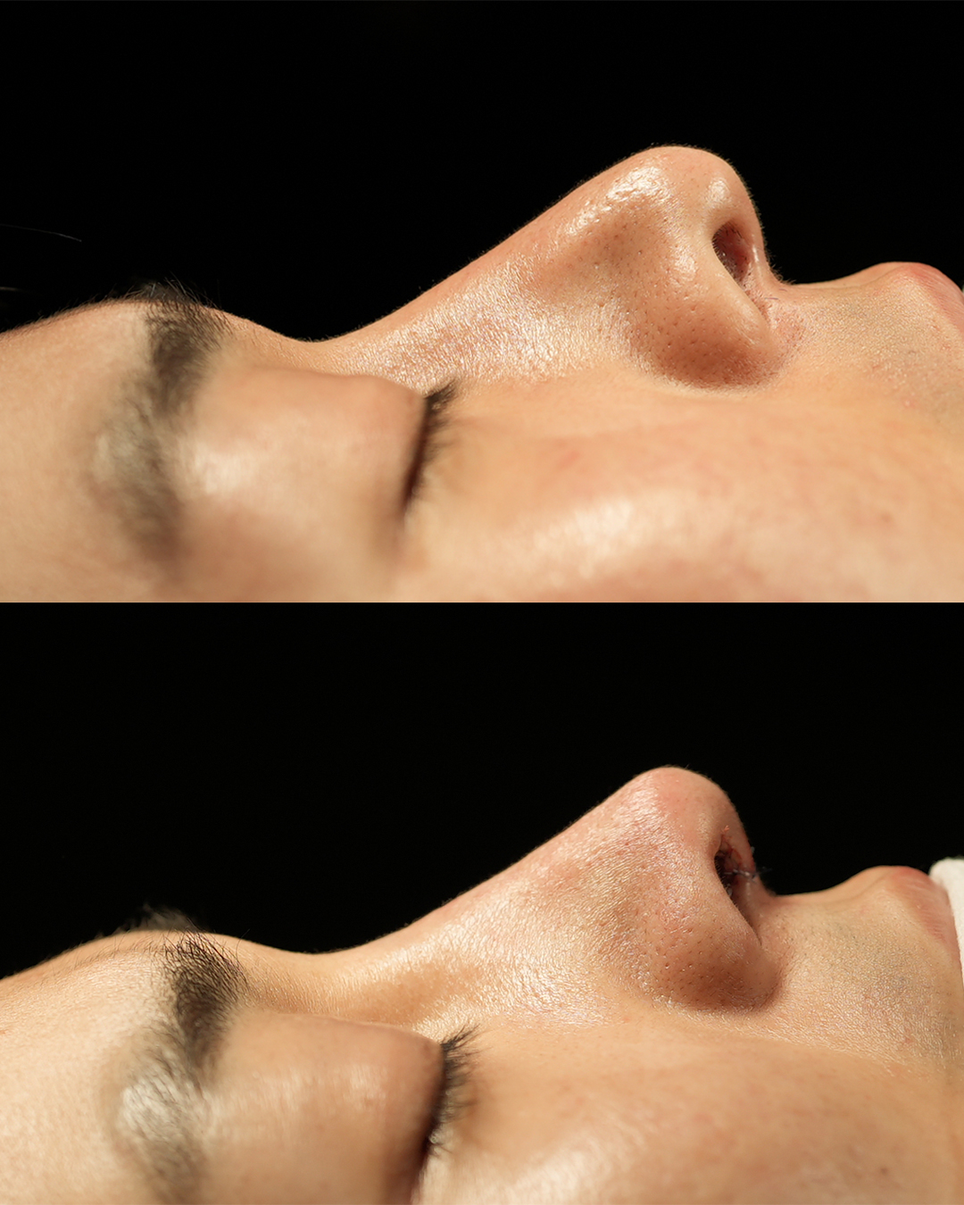 before-after-5.jpg