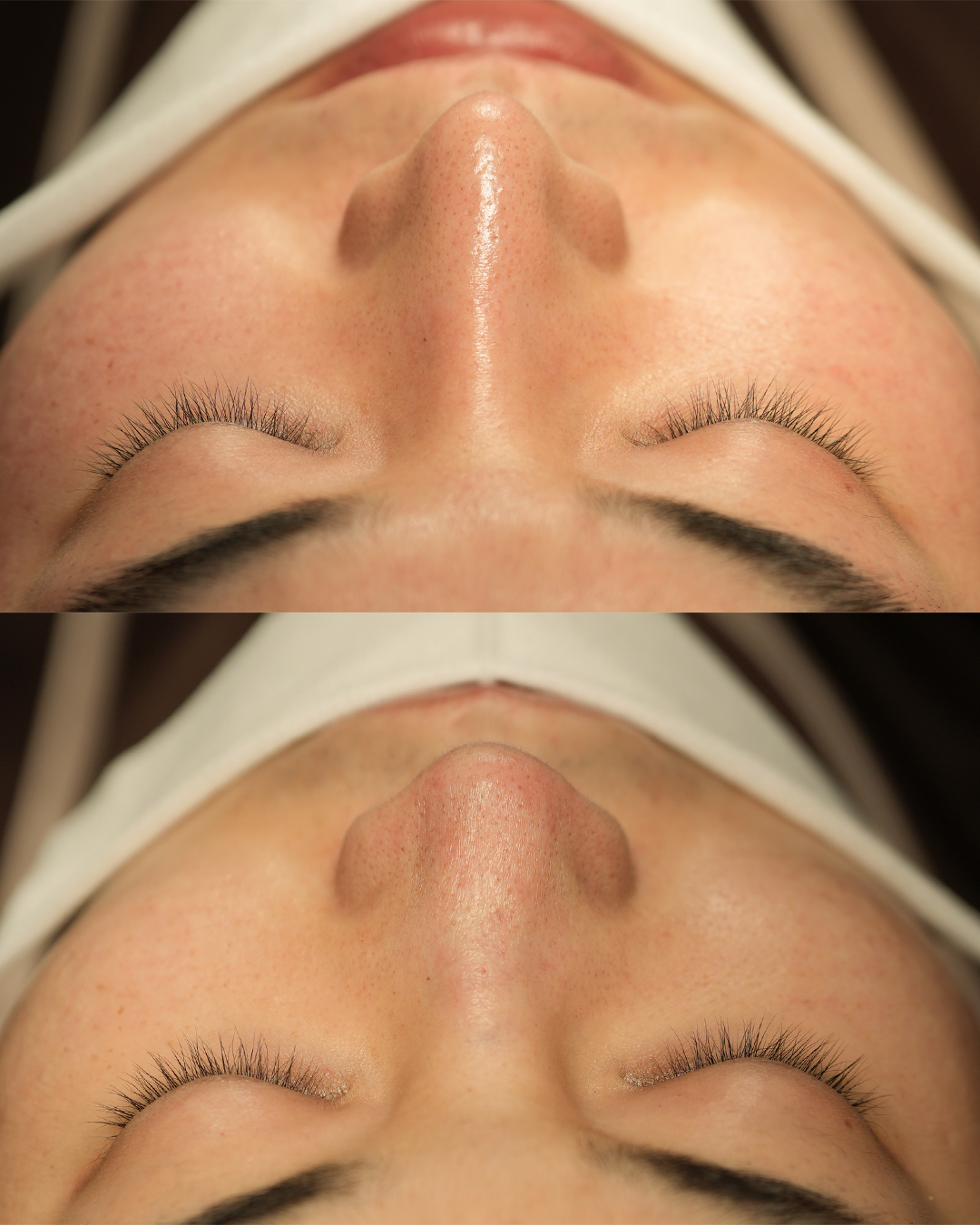 before-after-3.jpg