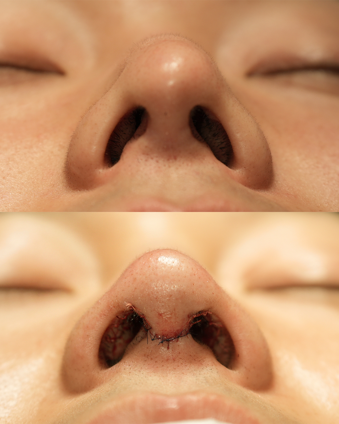 before-after-4.jpg