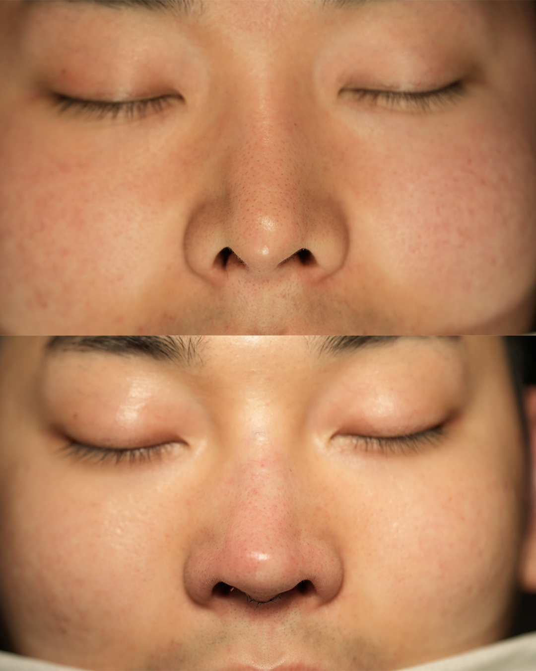 before-after-2.jpg