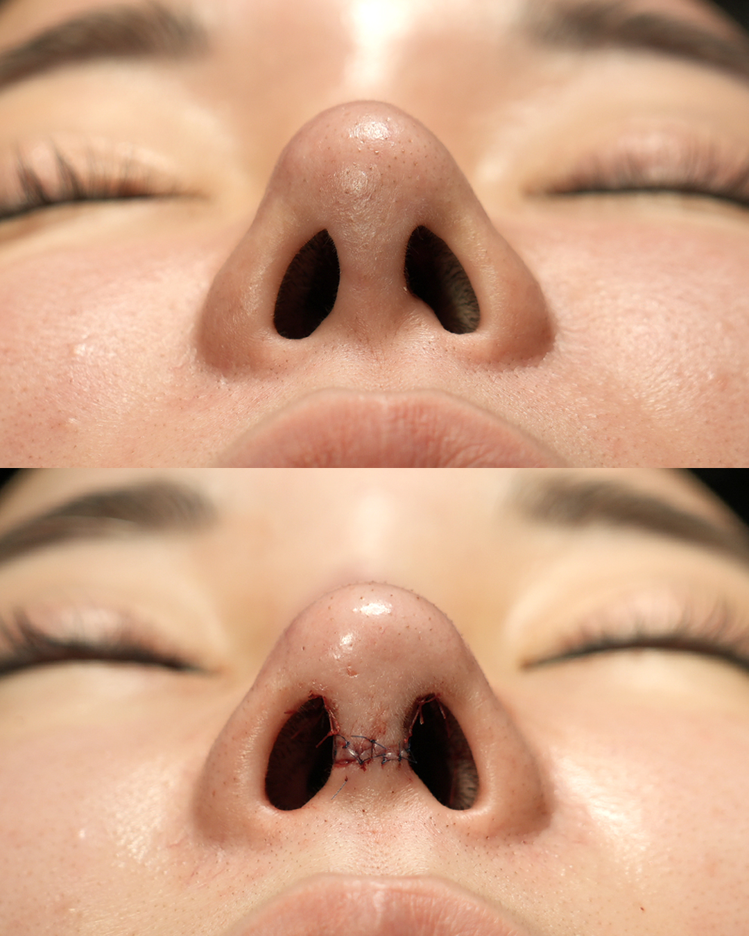 송두리3.jpg